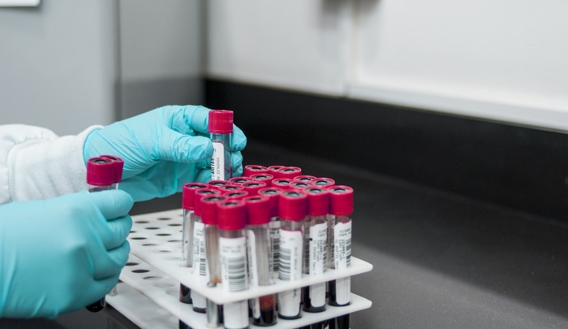 Обзор новостей и событий мясопереработки и животноводства за 38-ю неделю (17 – 21 сентября 2018 г.)