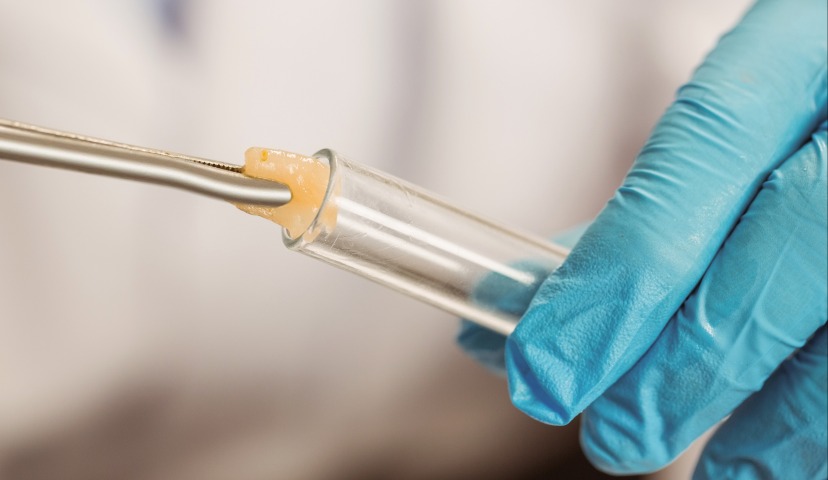 Вы бы съели мясо без применения убоя?