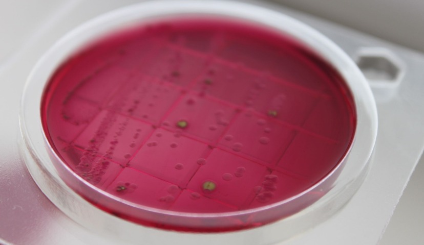 Микробиологические экспресс-тесты «Петритест» – быстрота и эффективность